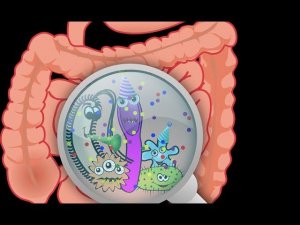 Истинные причины дисбактериоза