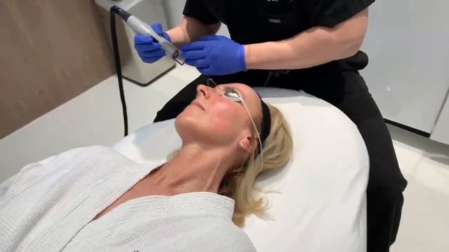 Vbeam Laser | Rosacea | West Hollywood, CA | Dr. Jason Emer смотреть онлайн