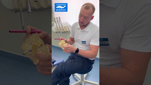 Когда нужна имплантация? смотреть онлайн