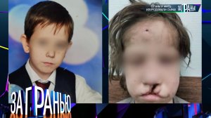 «За гранью»: «Отчим и мать изуродовали сына!» | Выпуск от 11 декабря 2024 года