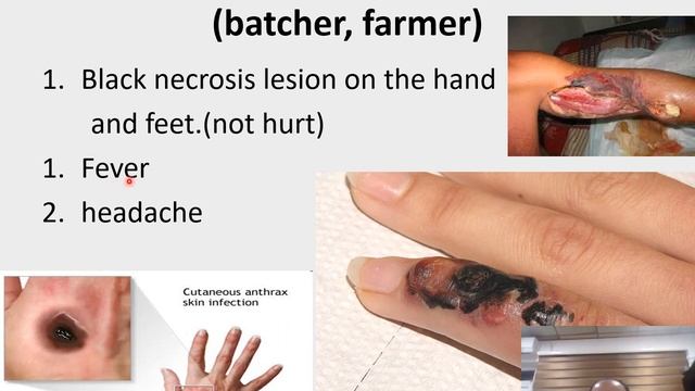 Bacillus anthracis смотреть онлайн