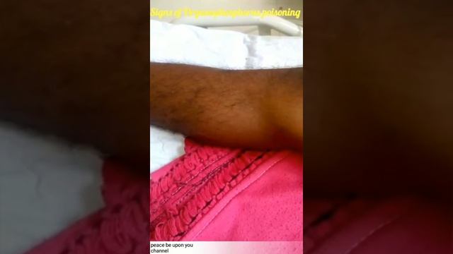 Fasiculations | Organophosphorus poisoning | Neurology India | Medical Videos | Critical Care смотреть онлайн