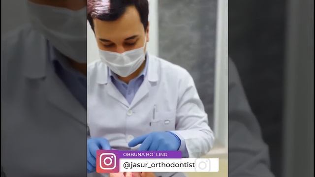 Breket Qo`yishdan Oldingi Holat Va Retension Apparat Qo`yish Jarayoni