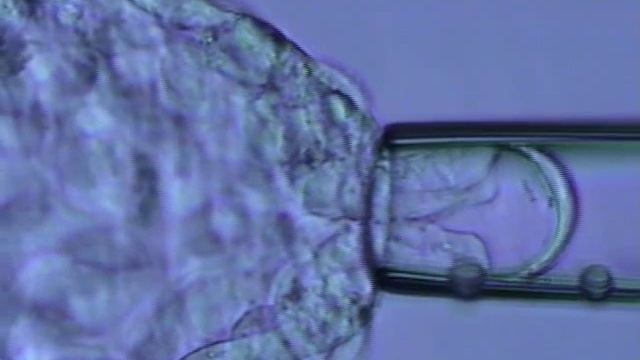 Trophectoderm Biopsy 4