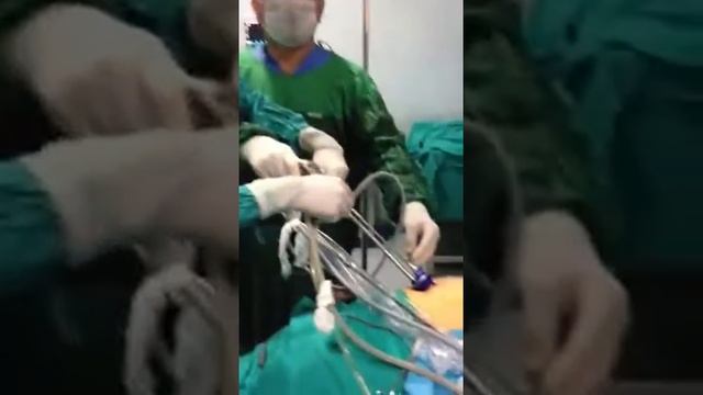 SILS. Одно портовая лапароскопическая хирургия. смотреть онлайн