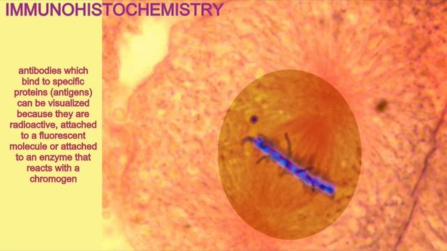 immunohistochemistry смотреть онлайн