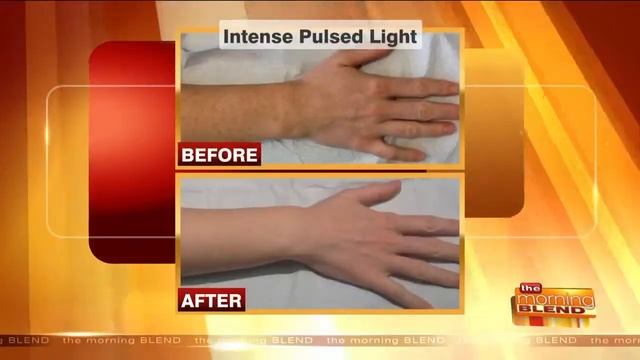 Dr. Manjoney on The Morning Blend: Keeping Your Neck + Hands Looking Young смотреть онлайн