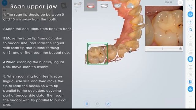 Intelliscan 3D Scanning Technique And Motion Control oral смотреть онлайн