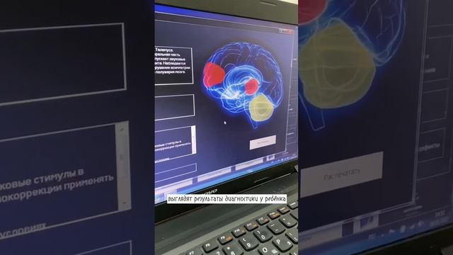 Диагностирование глубинных участков мозга смотреть онлайн