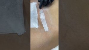 Депиляция воском бикини