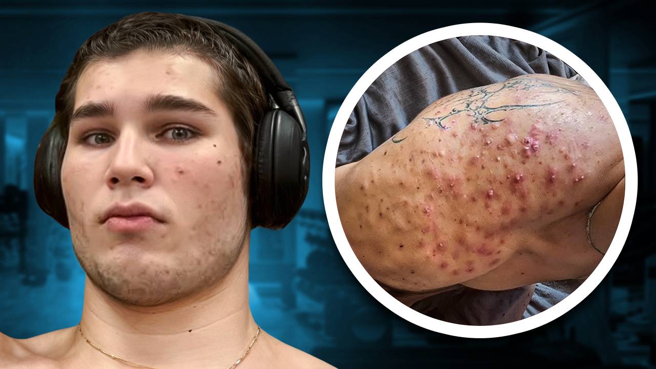 Личинка СМАЕВА Гниёт На Химии и Рад Этому смотреть онлайн