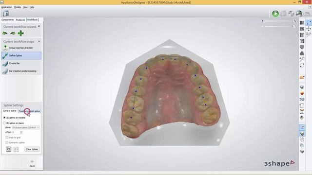 3Shape Appliance Designer - How to Create a Bar Fixed on Model Spline смотреть онлайн