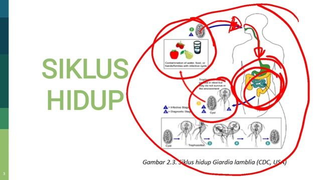 Giardiasis Akibat Infeksi Parasit Giardia Lamblia смотреть онлайн