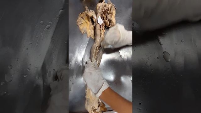 median nerve смотреть онлайн