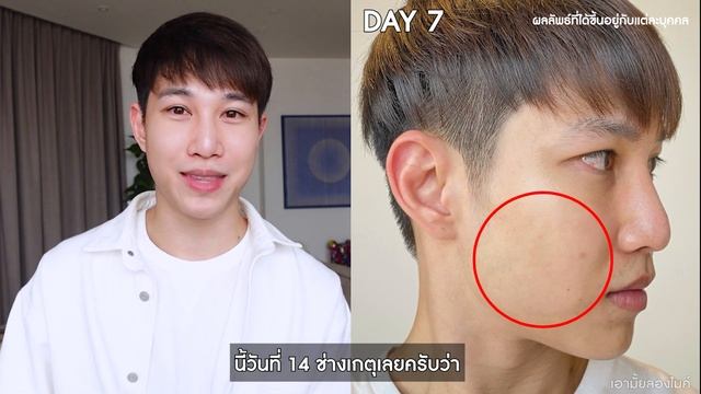 ลดรอยดำได้จริงขนาดไหน? กับ Eucerin Spotless Booster Serum | เอามั้ยลองไมค์ смотреть онлайн