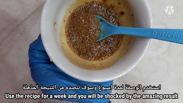 سواد الابط سوف يختفي كلمح البصر بهذه الوصفة المذهلة ، تخلصي من السواد تحت الابط смотреть онлайн