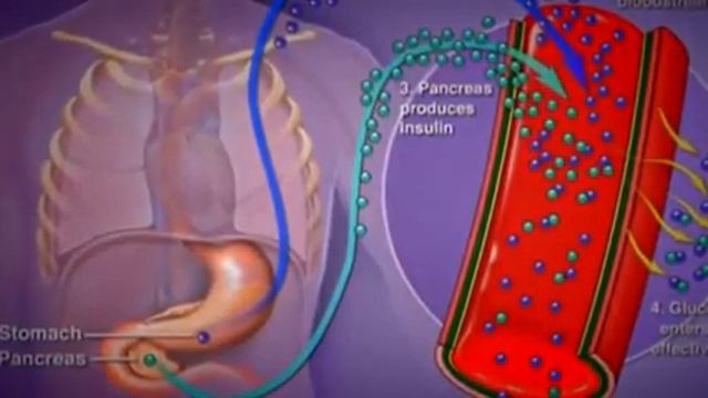 2014 03 12 Вебинар Павел Булин сахарный диабет смотреть онлайн