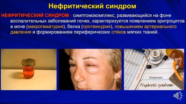 Гломерулонефриты смотреть онлайн