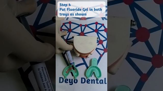 Fluoride Treatment Of Teeth By Fluoroyo Kit (Control Tooth Decay) смотреть онлайн