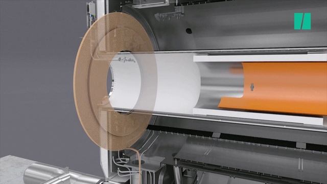 Une IRM surpuissante pour mieux détecter la maladie d'Alzheimer смотреть онлайн