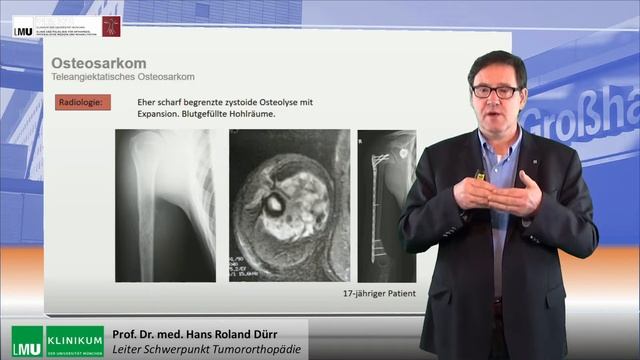 Diagnostik Und Therapie Des Osteosarkoms