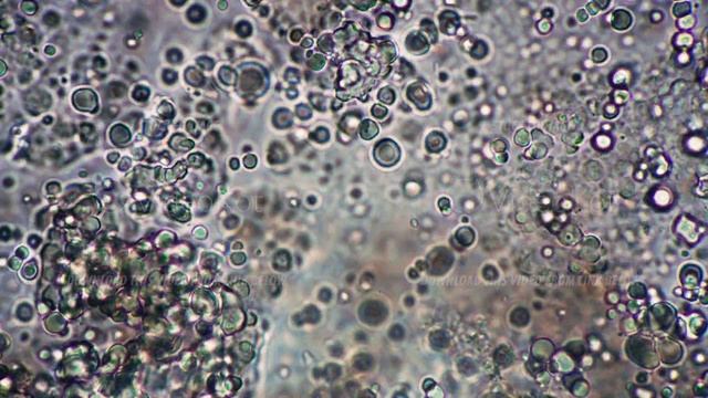 Clumps of sourdough round milk bacillus and sticks move quickly in the microscope смотреть онлайн