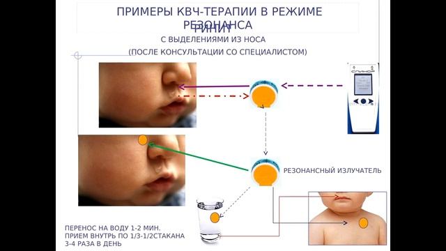 Прибор Спинор Технология ФРИ смотреть онлайн