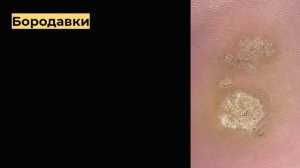 инфекционные заболевания кожи