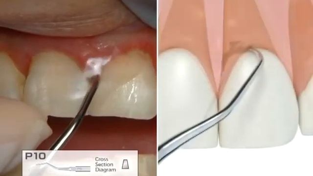 NSK - Varios 970 Lux