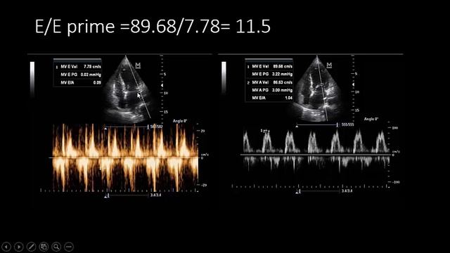 whole body sonar in septic shock [an evidenced based approach ] смотреть онлайн