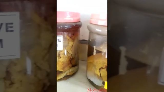 The Real Human Body Organs In Formalin...