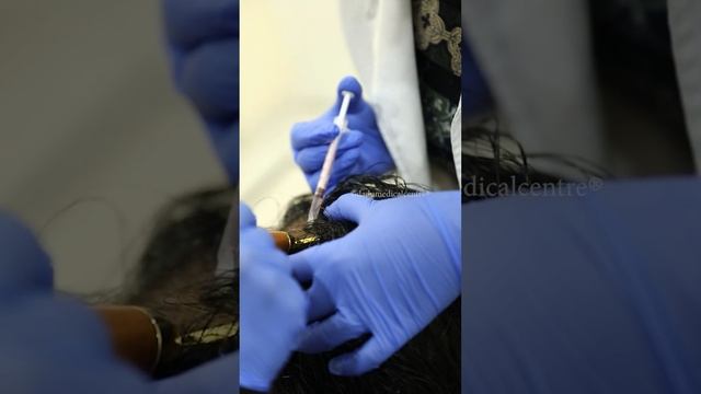 Best Treatment for Hair Loss | qr678 Hair Regrowth Therapy | Hair Clinic in Delhi | DMC Trichology смотреть онлайн