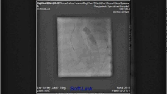 Faira Zarin 47 D 3Kg BAP for COA смотреть онлайн