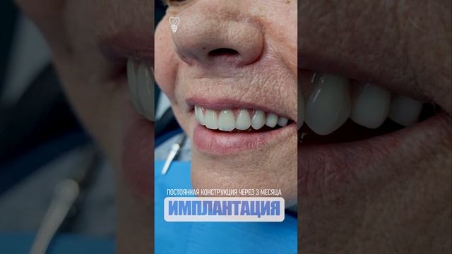 Эстетика временных зубов и постоянных. Aesthetics Of Temporary And Permanent Teeth.