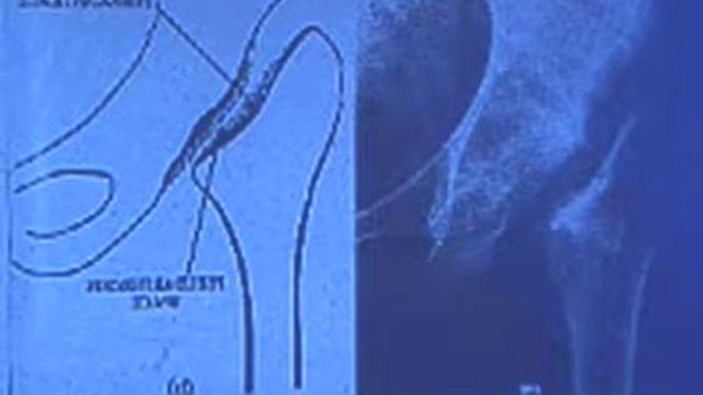 Hall A 8Dec T2 - IOACON2013