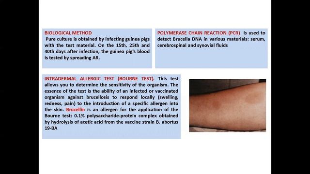 Zoonotic infections смотреть онлайн