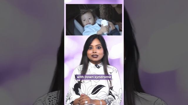 Can Down syndrome be detected in monthly scans? смотреть онлайн