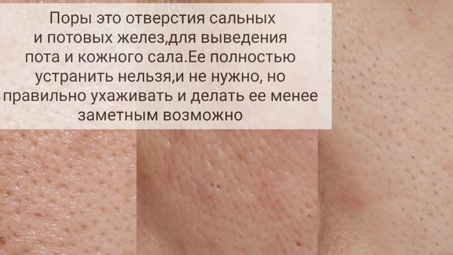 БЕТ ТЕСІГІ КЕҢІГЕН❗☝️РАСШИРЕННЫЕ ПОРЫ. ҮЙ ЖАҒДАЙЫНДА ЖАСАП КӨР смотреть онлайн