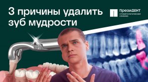 Зуб мудрости: удалять или нет? 🔧🦷 | Отвечает стоматолог сети клиник ПрезиДЕНТ💚