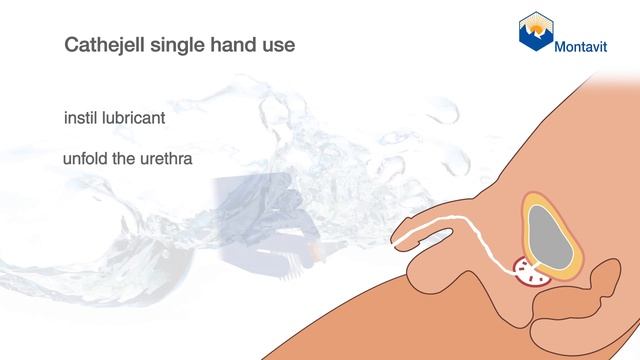 Cathejell Teaser Video