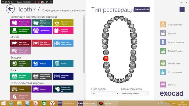 Знакомство с EXOCAD смотреть онлайн