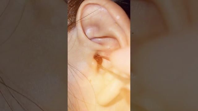Clean ears, nose, Body / 002 смотреть онлайн