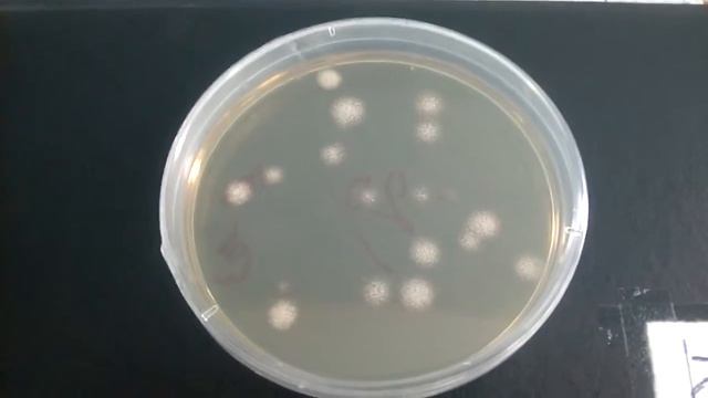 Colony of Bacillus Subtilis in B media смотреть онлайн