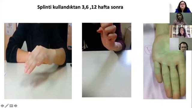 Ekstansör tendon yaralanmaları ve rehabilitasyonu смотреть онлайн