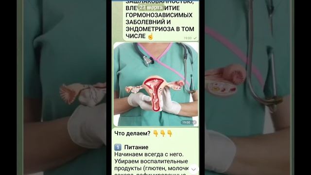 #женскоездоровье #эндометриоз #миома #климакс смотреть онлайн