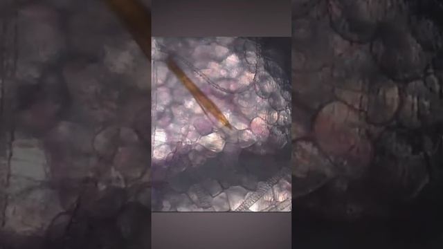 Царство кровососуших
