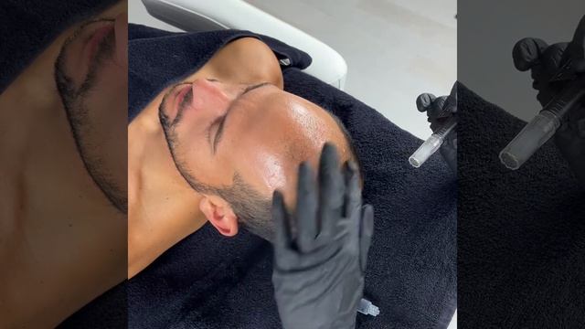 Micro Needling Fusion Hair смотреть онлайн