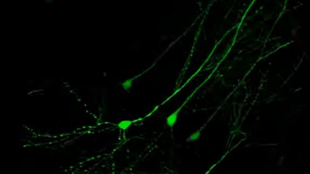 Mouse Brain Sections - 233 Micron - 3 D смотреть онлайн