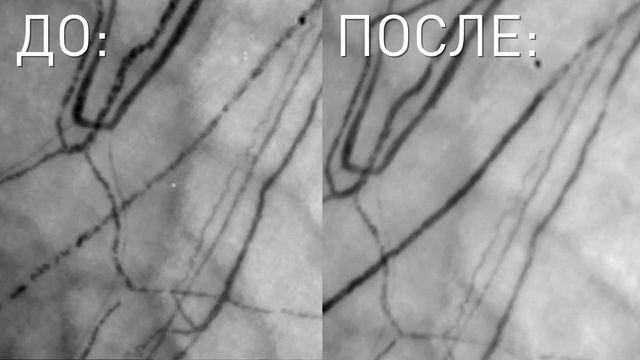 Прогноз и программа профилактики