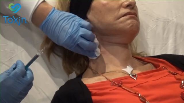 Hidroxiopatita de calcio crystalys смотреть онлайн